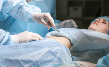 Chirurgo plastico Seno in Roma