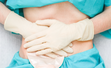 Flebo ed infusioni venose roma