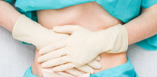 Flebo ed infusioni venose roma