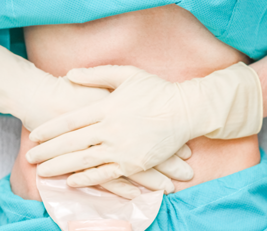 Flebo ed infusioni venose roma