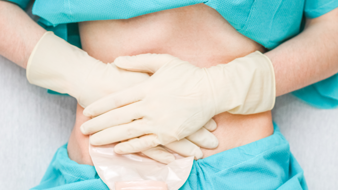 Flebo ed infusioni venose roma