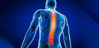 Ozonoterapia Costi per Seduta Roma